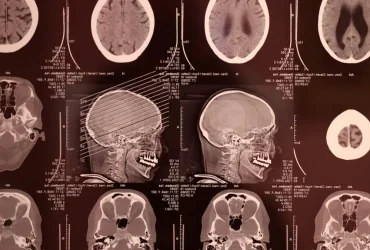 Meta’s Brain2Qwerty v2: AI Překládá Mozkové Snímky do Textu